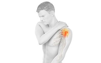 Donuk Omuz (Frozen Shoulder)
