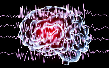 Epilepsi