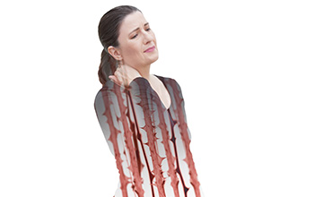 Fibromiyalji