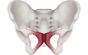 Osteitis Pubis