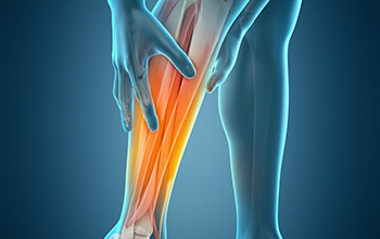 Peroneal Sinir Tuzaklanması