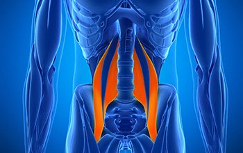 Psoas Sendromu