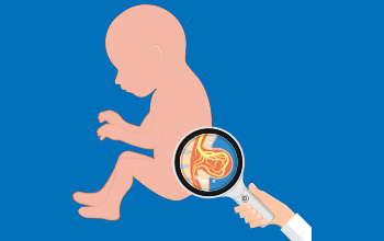 Spina Bifida ve Doğumsal Omurilik Hastalıklar