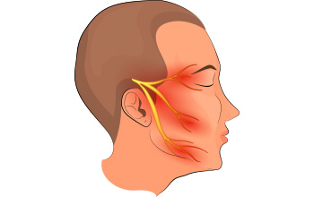Trigeminal Nevralji ve Hemifasyal Spazm