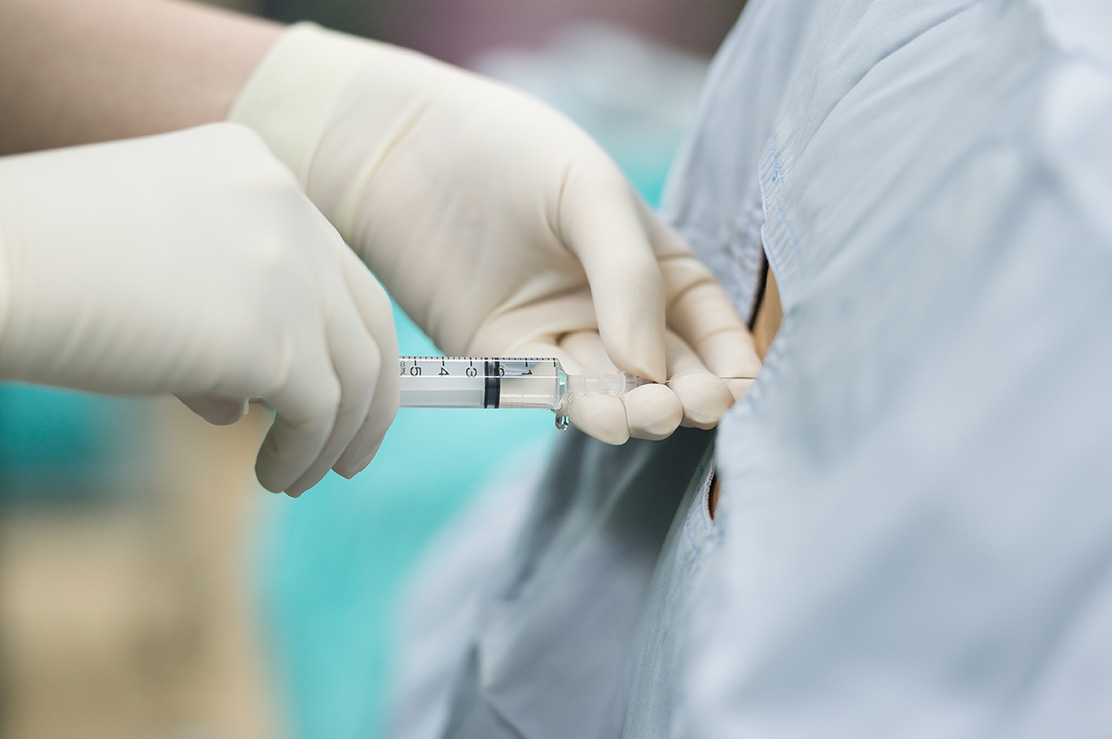 Epidural Enjeksiyon Epidural Enjeksiyon