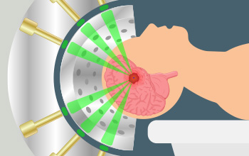 Gamma Knife, Stereotaksik Radyocerrahi