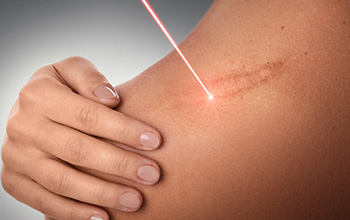 Dermatolojik Tedaviler Dermatolojik Tedaviler