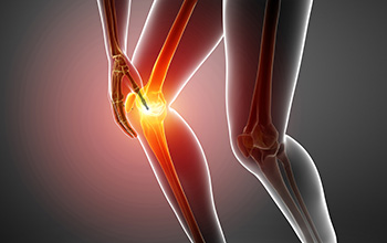 Menisküs Rehabilitasyonu Menisküs Rehabilitasyonu